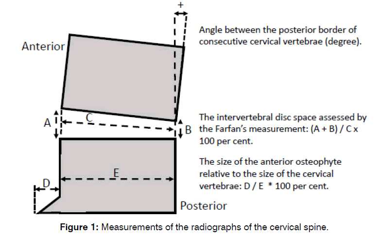 tinnitus-cervical-spine